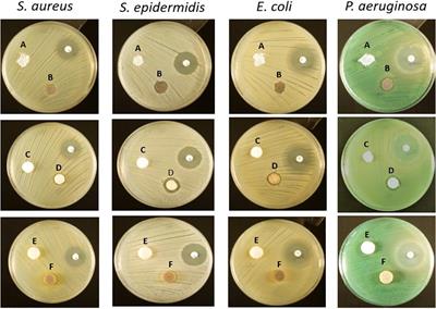 Response of Human Macrophages to Clinically Applied Wound Dressings Loaded With Silver